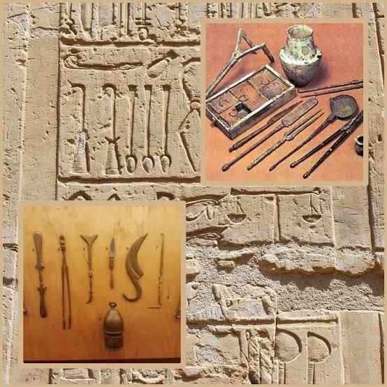 ancient egyptian medicine Copper Scalpels and Trepanation Instruments